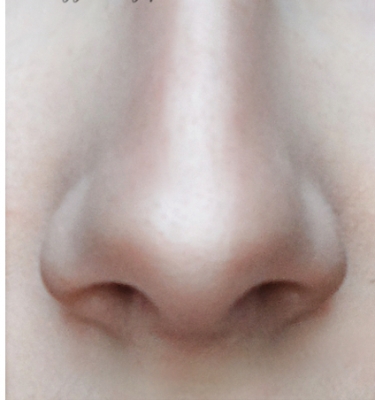 nose3.jpg