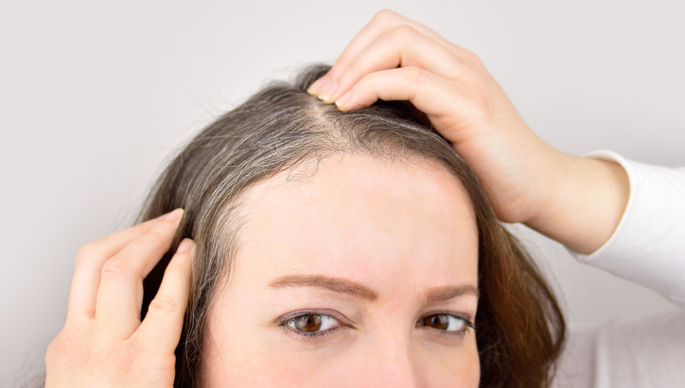 وصفات طبيعية لمحاربة الشعر الأبيض