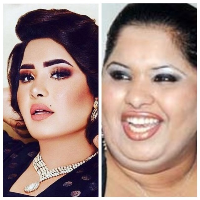 عمليات التجميل للفنانات العرب في 2019