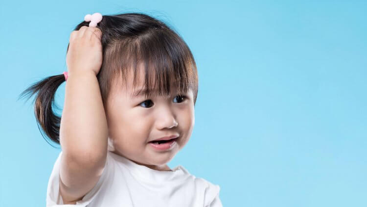  قشرة الشعر عند الاطفال
