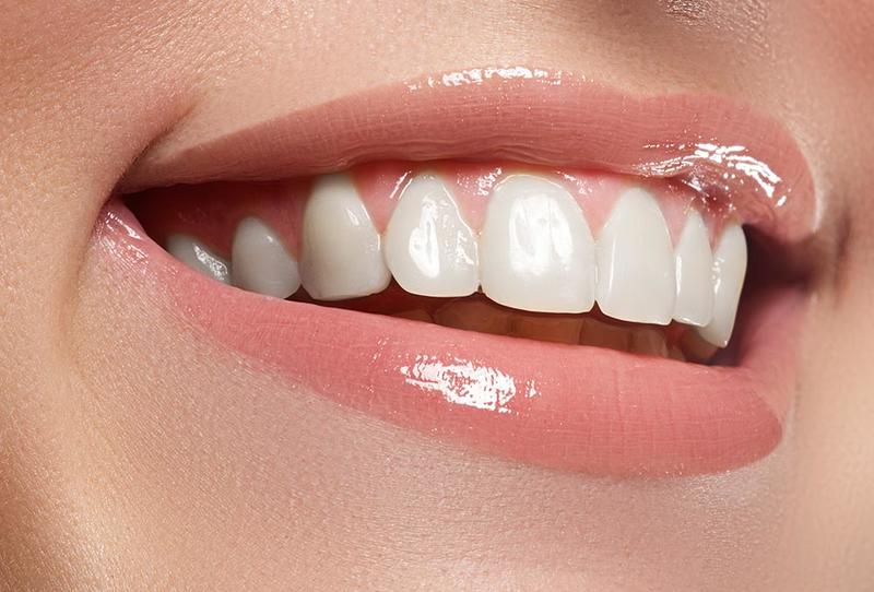 طرق طبيعية لأسنان بيضاء وناصعة