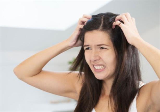 نصائح للتخلص من حكة الشعر