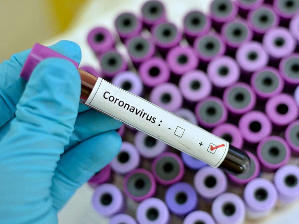 هل تم اكتشاف علاج لفيروس كورونا 