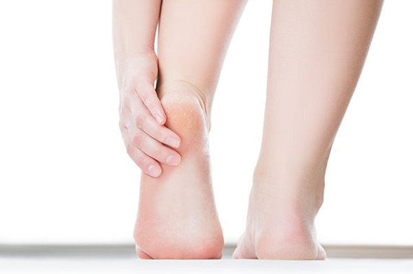 وصفات لعلاج تشقّق القدمين